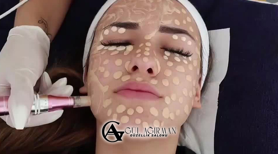 Antalya BB Shine Uygulaması